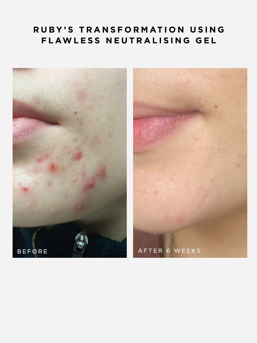 Flawless Neutralising Gel - Image 3