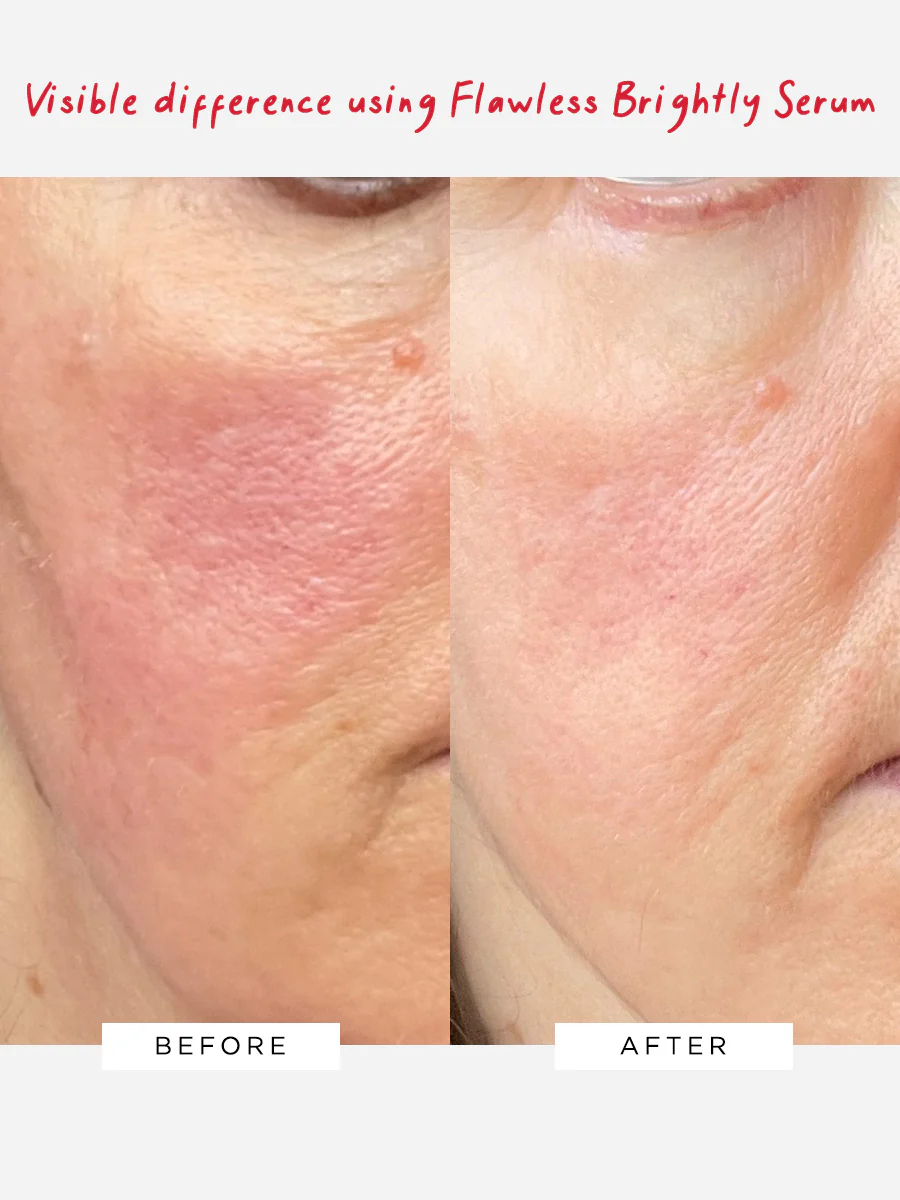 The Radiance Pro Duo - Image 2